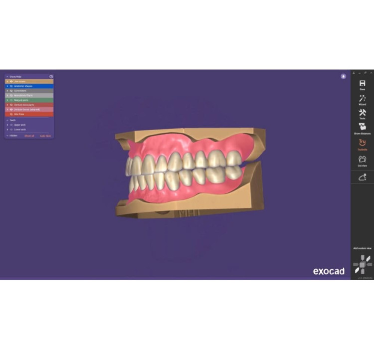 exocad presenta Inspira™ Denture Tooth Library